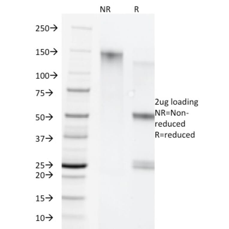 SDS-PAGE - Anti-Cytokeratin 5 + 8 Antibody [C-50] - BSA and Azide free (A254054) - Antibodies.com