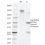 SDS-PAGE - Anti-Cytokeratin 5 + 8 Antibody [C-50] - BSA and Azide free (A254054) - Antibodies.com