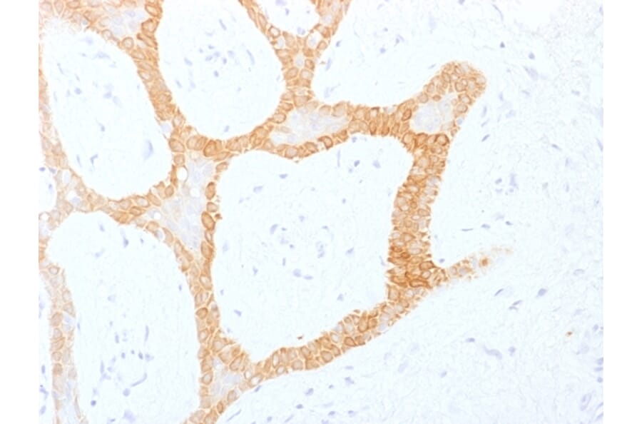 Immunohistochemistry - Anti-Cytokeratin 5 + 8 Antibody [C-50] - BSA and Azide free (A254053) - Antibodies.com