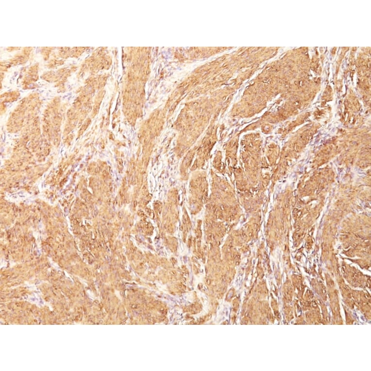 Immunohistochemistry - Anti-Muscle Actin Antibody [HHF35] - BSA and Azide free (A254056) - Antibodies.com