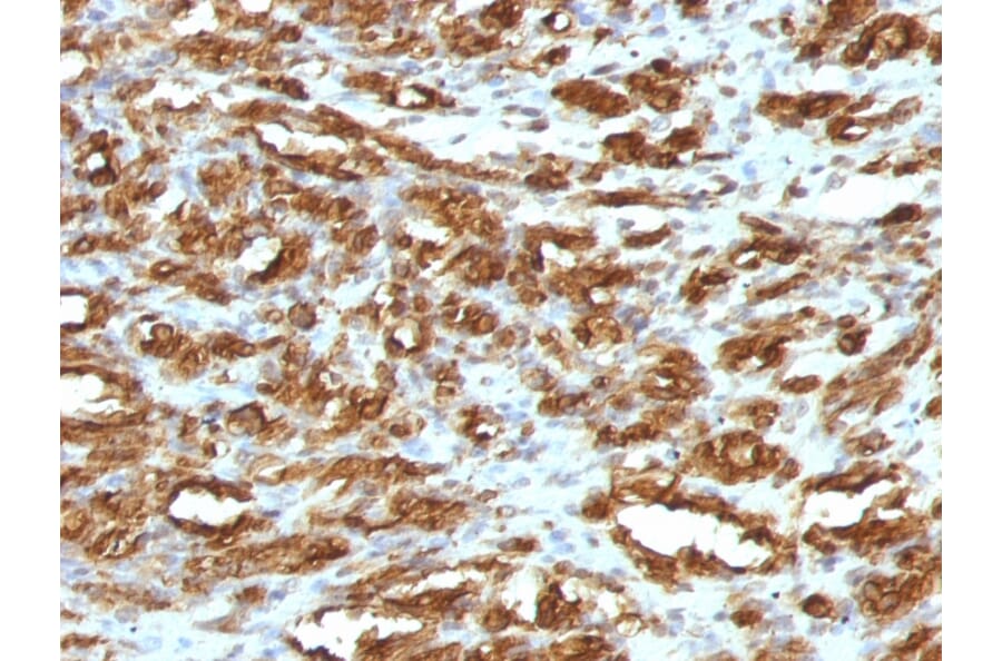 Immunohistochemistry - Anti-Muscle Actin Antibody [HHF35] - BSA and Azide free (A254057) - Antibodies.com
