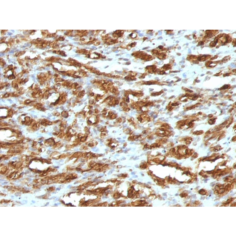 Immunohistochemistry - Anti-Muscle Actin Antibody [HHF35] - BSA and Azide free (A254057) - Antibodies.com