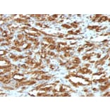 Immunohistochemistry - Anti-Muscle Actin Antibody [HHF35] - BSA and Azide free (A254057) - Antibodies.com