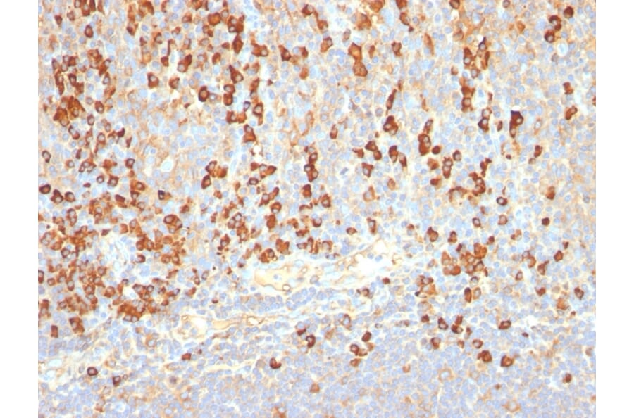 Immunohistochemistry - Anti-Plasma Cell Antibody [LIV3G11] - BSA and Azide free (A254058) - Antibodies.com
