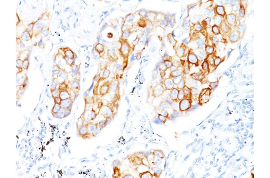 Immunohistochemistry - Anti-Cytokeratin 7 + 17 Antibody [C-46] - BSA and Azide free (A250880) - Antibodies.com