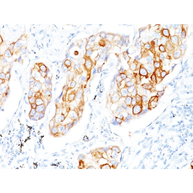 Immunohistochemistry - Anti-Cytokeratin 7 + 17 Antibody [C-46] - BSA and Azide free (A250880) - Antibodies.com