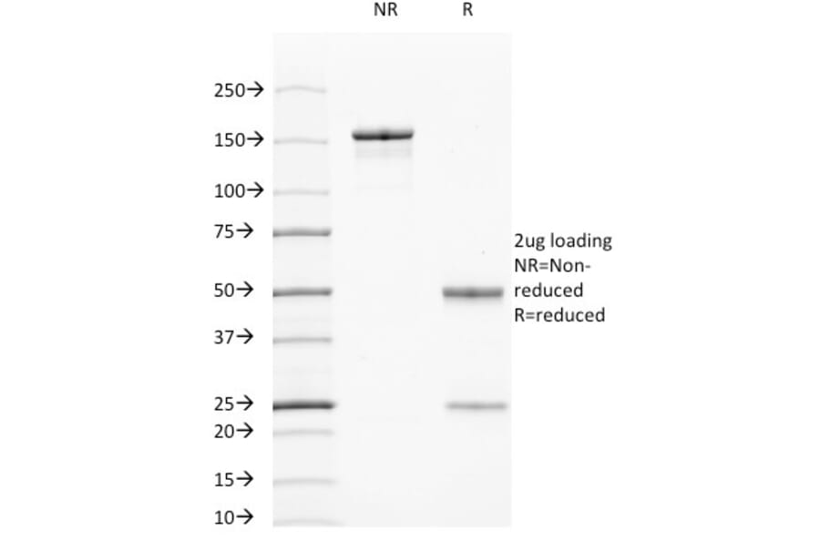 SDS-PAGE - Anti-Cytokeratin 7 + 17 Antibody [C-46] - BSA and Azide free (A250880) - Antibodies.com