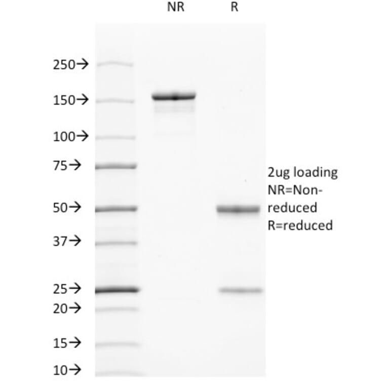 SDS-PAGE - Anti-Cytokeratin 7 + 17 Antibody [C-46] - BSA and Azide free (A250880) - Antibodies.com