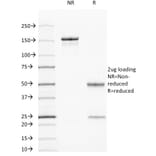 SDS-PAGE - Anti-Cytokeratin 7 + 17 Antibody [C-46] - BSA and Azide free (A250880) - Antibodies.com