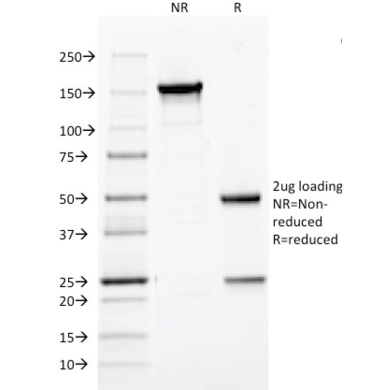 SDS-PAGE - Anti-HPV16 L1 Antibody [CAMVIR-1] - BSA and Azide free (A254061) - Antibodies.com