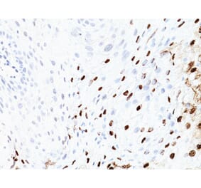 Immunohistochemistry - Anti-HPV16 L1 Antibody [SPM405] - BSA and Azide free (A254061) - Antibodies.com