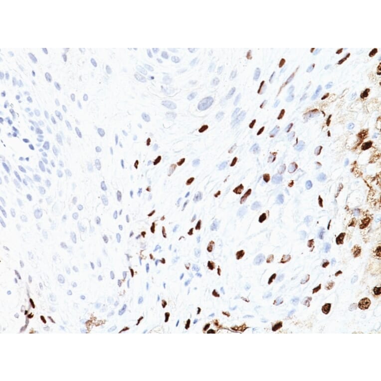 Immunohistochemistry - Anti-HPV16 L1 Antibody [SPM405] - BSA and Azide free (A254061) - Antibodies.com