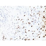 Immunohistochemistry - Anti-HPV16 L1 Antibody [SPM405] - BSA and Azide free (A254061) - Antibodies.com