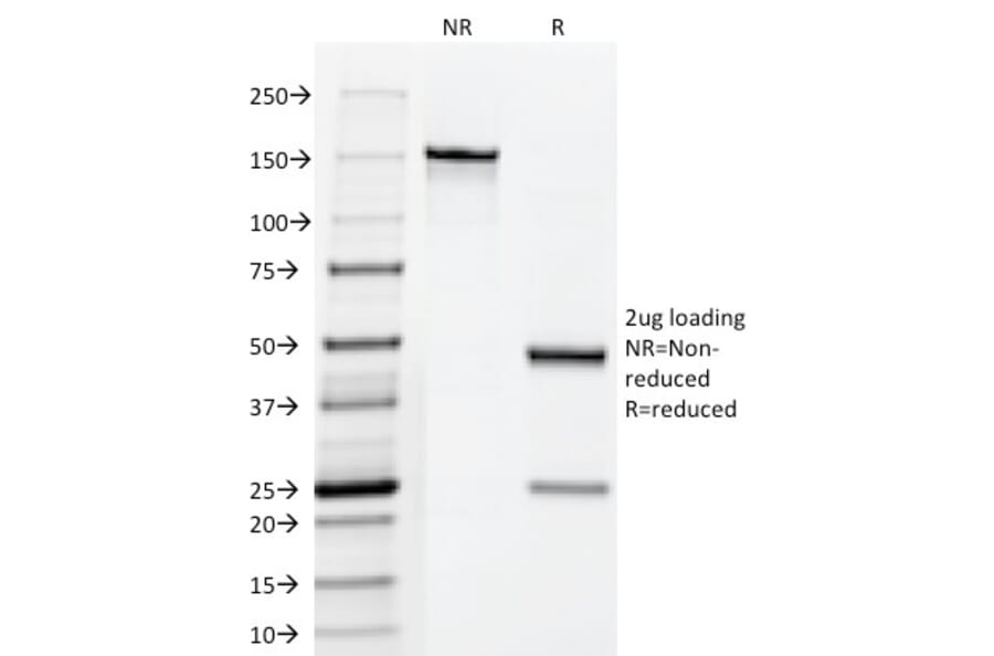 SDS-PAGE - Anti-HCG Holo Antibody [HCGab/52] - BSA and Azide free (A254063) - Antibodies.com