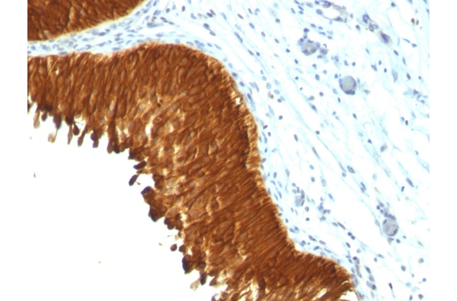 Immunohistochemistry - Anti-pan Cytokeratin Antibody [KRT/457] - BSA and Azide free (A254063) - Antibodies.com