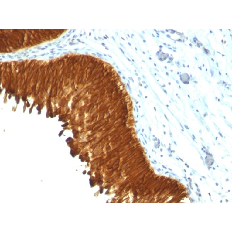 Immunohistochemistry - Anti-pan Cytokeratin Antibody [KRT/457] - BSA and Azide free (A254063) - Antibodies.com