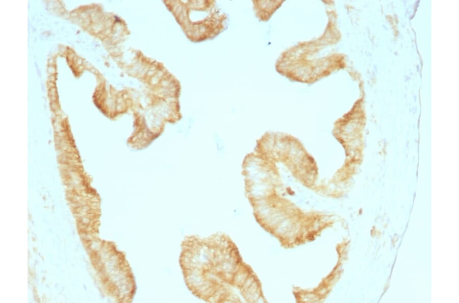 Immunohistochemistry - Anti-pan Cytokeratin Antibody [KRT/457] - BSA and Azide free (A254064) - Antibodies.com