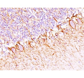 Immunohistochemistry - Anti-Neurofilament Heavy Polypeptide Antibody [NF421 + NFL/736] - BSA and Azide free (A254066) - Antibodies.com