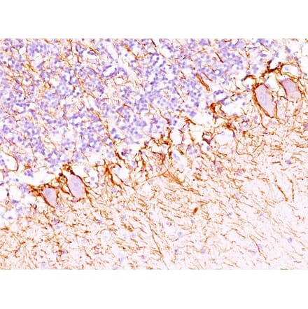 Immunohistochemistry - Anti-Neurofilament Heavy Polypeptide Antibody [NF421 + NFL/736] - BSA and Azide free (A254066) - Antibodies.com