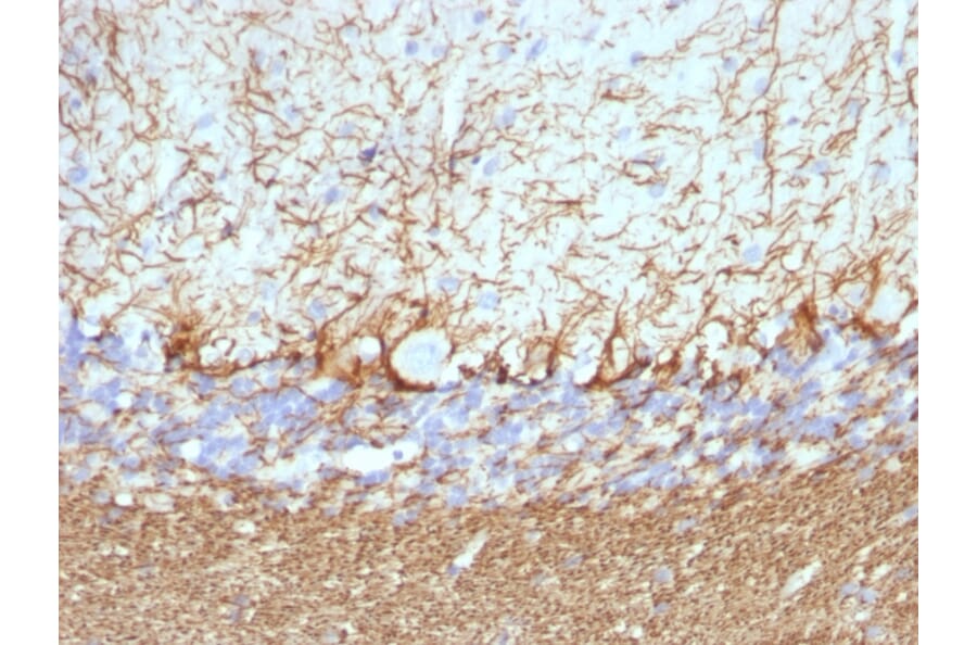 Immunohistochemistry - Anti-Neurofilament Heavy Polypeptide Antibody [NF421 + NFL/736] - BSA and Azide free (A254066) - Antibodies.com