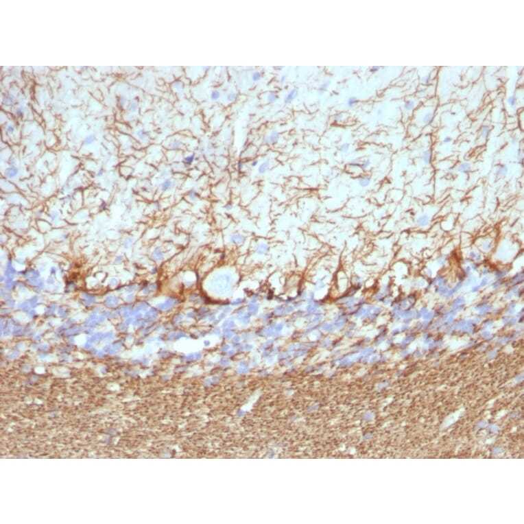 Immunohistochemistry - Anti-Neurofilament Heavy Polypeptide Antibody [NF421 + NFL/736] - BSA and Azide free (A254066) - Antibodies.com