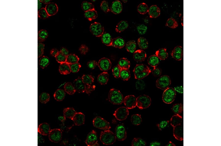 Immunofluorescence - Anti-Neurofilament Heavy Polypeptide Antibody [NF421 + NFL/736] - BSA and Azide free (A254066) - Antibodies.com