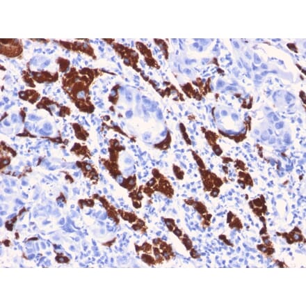 Immunohistochemistry - Anti-Hepatocyte Specific Antigen Antibody [OCH1E5] - BSA and Azide free (A254068) - Antibodies.com