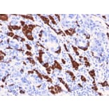Immunohistochemistry - Anti-Hepatocyte Specific Antigen Antibody [OCH1E5] - BSA and Azide free (A254068) - Antibodies.com