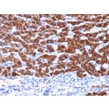 Immunohistochemistry - Anti-Hepatocyte Specific Antigen Antibody [OCH1E5] - BSA and Azide free (A254066) - Antibodies.com
