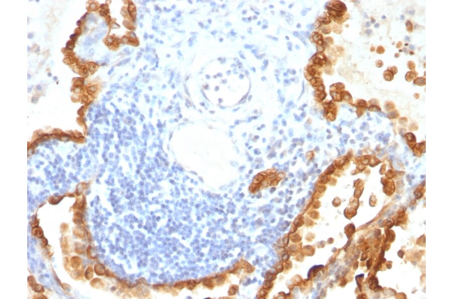 Immunohistochemistry - Anti-Cytokeratin 8 + 18 Antibody [KRT8/803 + KRT18/835] - BSA and Azide free (A254069) - Antibodies.com
