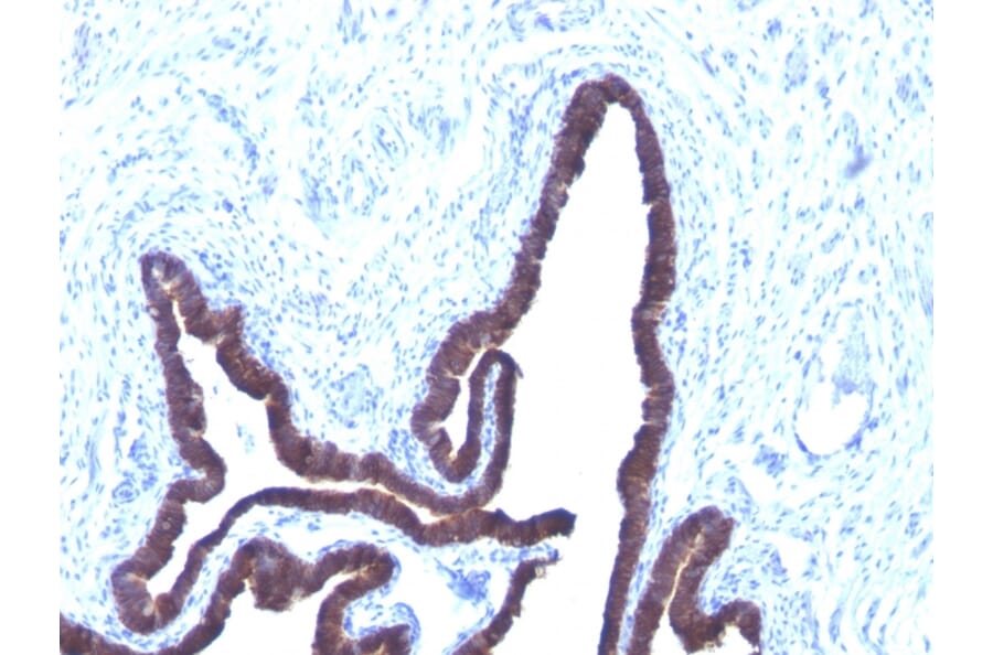 Immunohistochemistry - Anti-Cytokeratin 8 + 18 Antibody [KRT8/803 + KRT18/835] - BSA and Azide free (A254069) - Antibodies.com