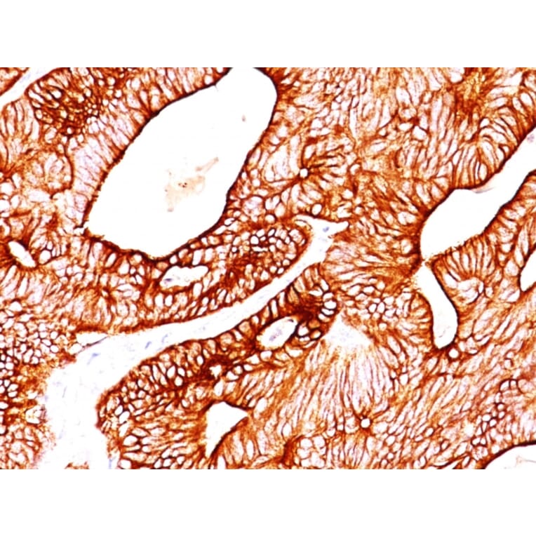 Immunohistochemistry - Anti-Cytokeratin 8 + 18 Antibody [KRT8/803 + KRT18/835] - BSA and Azide free (A254068) - Antibodies.com