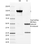 SDS-PAGE - Anti-Cytokeratin 8 + 18 Antibody [KRT8/803 + KRT18/835] - BSA and Azide free (A254069) - Antibodies.com