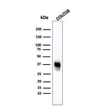 Western Blot - Anti-Melanoma Marker (MART-1 + Tyrosinase + gp100) Antibody [M2-7C10 + M2-9E3 + T311 + HMB45] - BSA and Azide free (A254070) - Antibodies.com