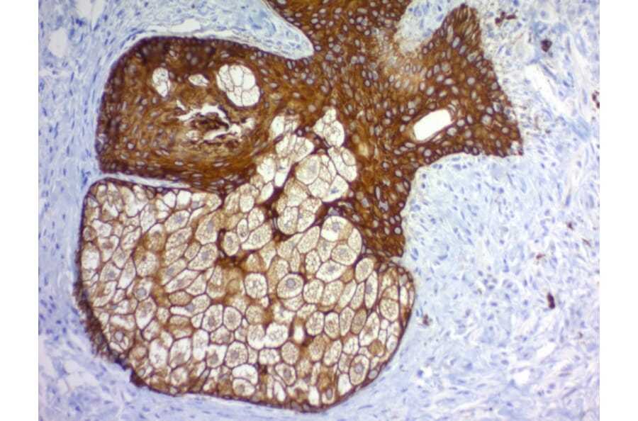 Immunohistochemistry - Anti-pan Cytokeratin Antibody [Cocktail PAN-CK] - BSA and Azide free (A254072) - Antibodies.com