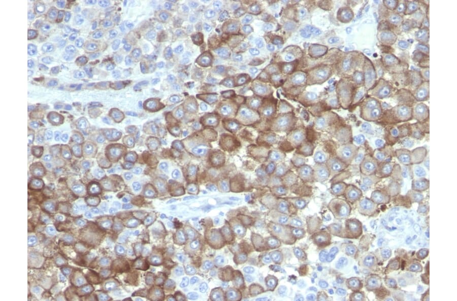 Immunohistochemistry - Anti-PNL2 Antibody [PNL2] - BSA and Azide free (A254072) - Antibodies.com
