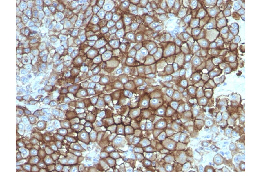 Immunohistochemistry - Anti-Melanoma Associated Antigen KBA.62 Antibody [KBA.62] - BSA and Azide free (A254073) - Antibodies.com