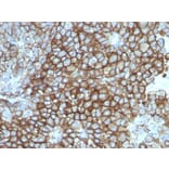 Immunohistochemistry - Anti-Melanoma Associated Antigen KBA.62 Antibody [KBA.62] - BSA and Azide free (A254073) - Antibodies.com