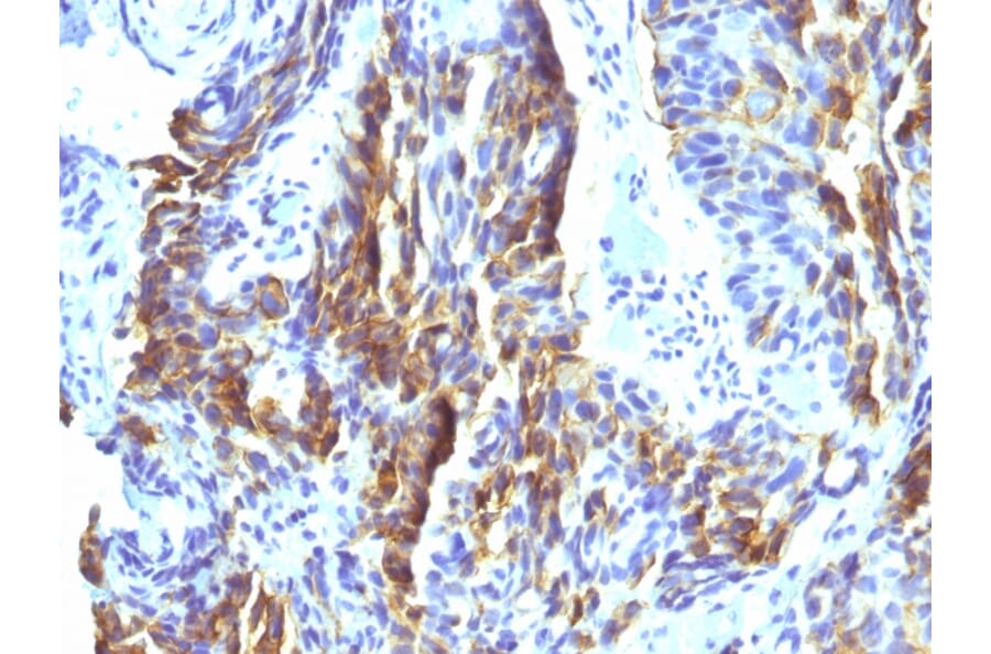 Immunohistochemistry - Anti-Melanoma Associated Antigen KBA.62 Antibody [KBA.62] - BSA and Azide free (A254074) - Antibodies.com