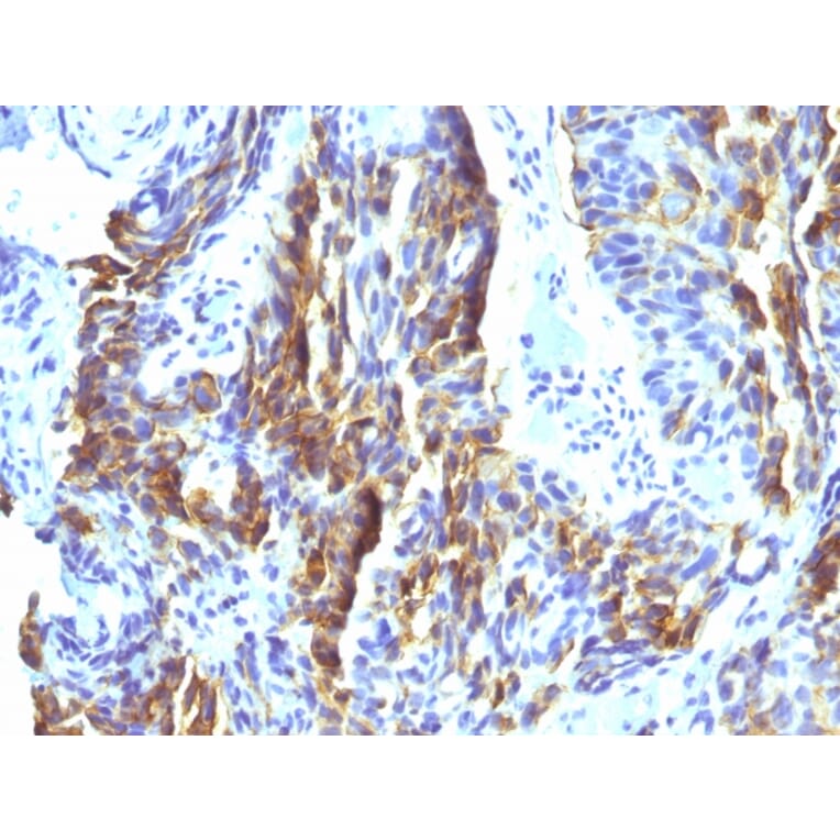Immunohistochemistry - Anti-Melanoma Associated Antigen KBA.62 Antibody [KBA.62] - BSA and Azide free (A254074) - Antibodies.com