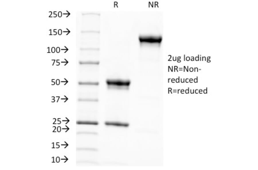 SDS-PAGE - Anti-Melanoma Associated Antigen KBA.62 Antibody [KBA.62] - BSA and Azide free (A254074) - Antibodies.com