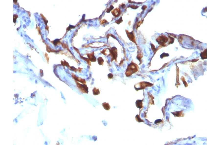 Immunohistochemistry - Anti-Cytokeratin 8 + 18 Antibody [C-51] - BSA and Azide free (A254074) - Antibodies.com
