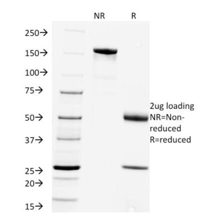 SDS-PAGE - Anti-Rabies Virus Antibody [Rab-50] - BSA and Azide free (A254075) - Antibodies.com