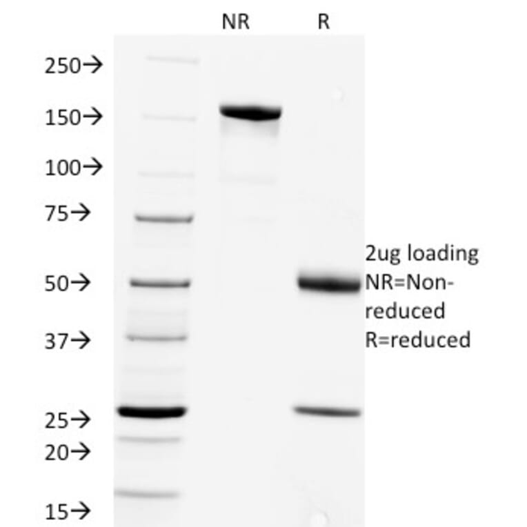 SDS-PAGE - Anti-Rabies Virus Antibody [Rab-50] - BSA and Azide free (A254075) - Antibodies.com
