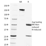 SDS-PAGE - Anti-Rabies Virus Antibody [Rab-50] - BSA and Azide free (A254075) - Antibodies.com