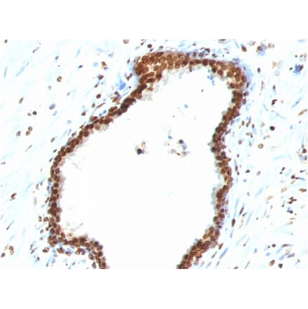 Immunohistochemistry - Anti-ds DNA Antibody [121-3] - BSA and Azide free (A254076) - Antibodies.com