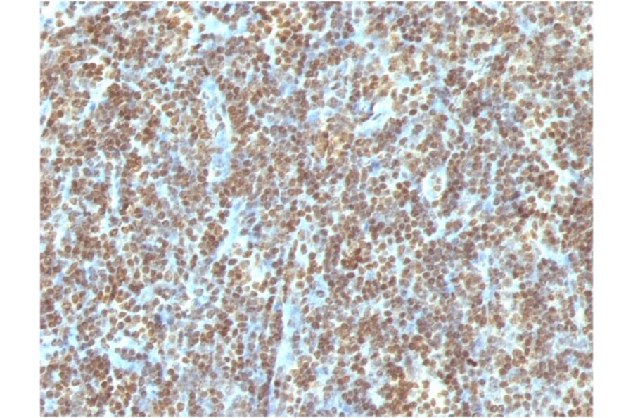 Immunohistochemistry - Anti-ds DNA Antibody [121-3] - BSA and Azide free (A254077) - Antibodies.com