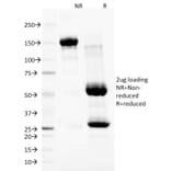 SDS-PAGE - Anti-Nuclear Membrane Antibody [NM97] - BSA and Azide free (A254077) - Antibodies.com