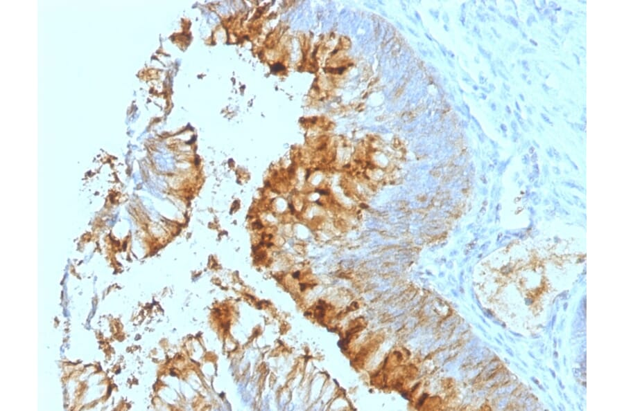 Immunohistochemistry - Anti-Blood Group Lewis a Antibody [SPM279] - BSA and Azide free (A254081) - Antibodies.com