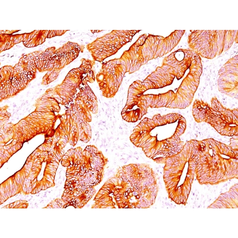 Immunohistochemistry - Anti-pan Cytokeratin Antibody [SPM583] - BSA and Azide free (A254082) - Antibodies.com